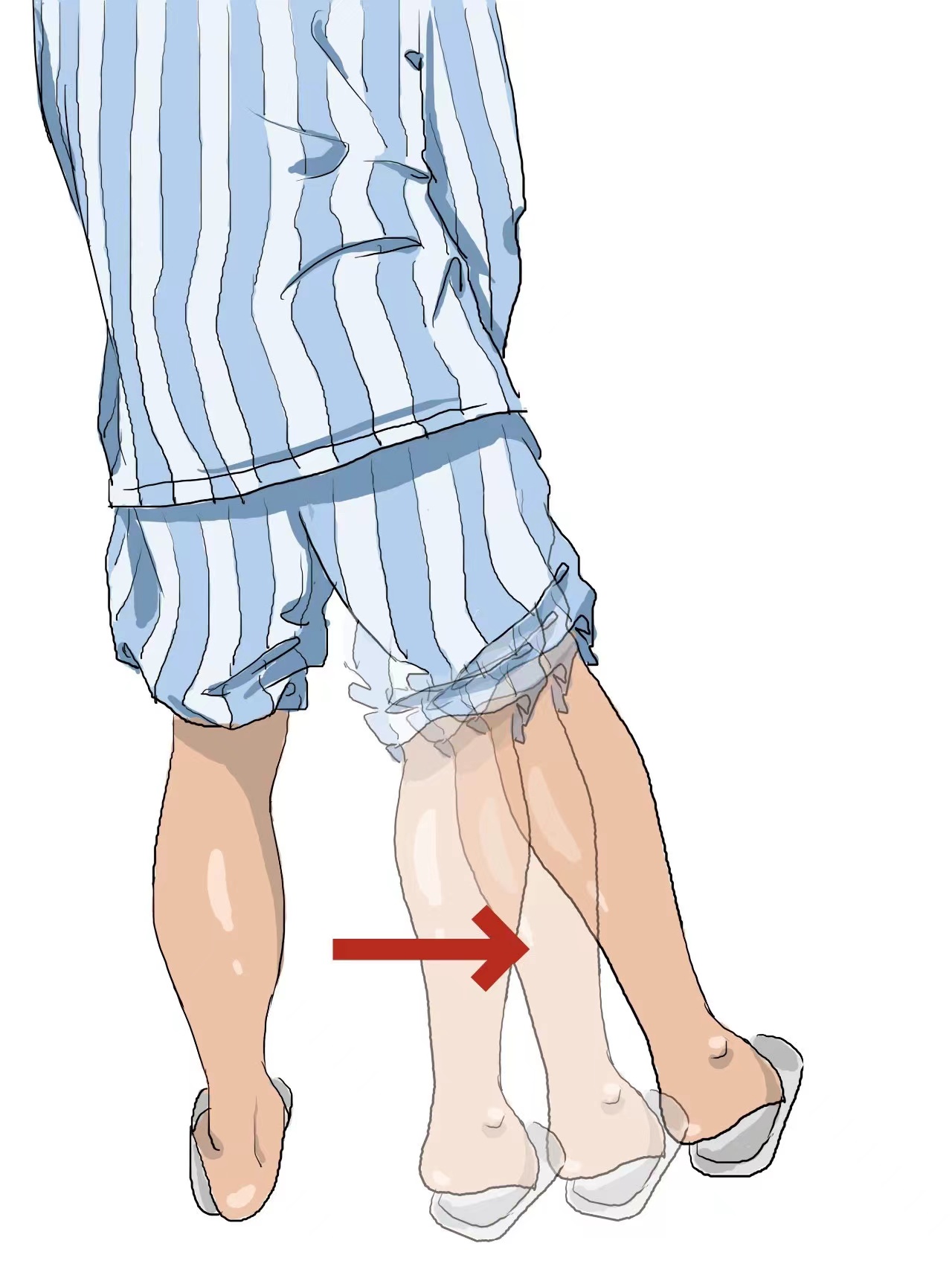 髖關節(jié)置換術后康復