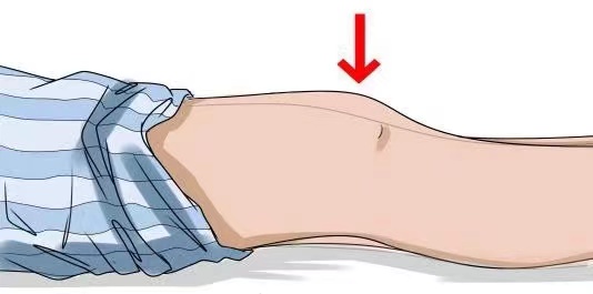 髖關節(jié)置換術后康復