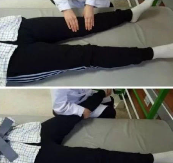 膝過伸不煩惱，康復訓練有妙招